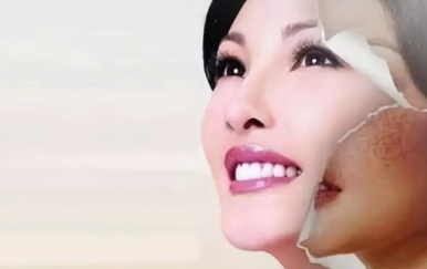 一年中最佳的祛斑時間，那無疑是秋季。